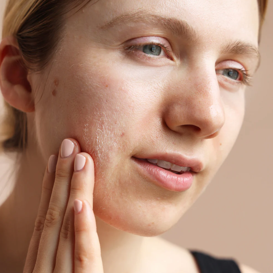 Bioelements PORE THING | Prausiklis su azelaino rūgštimi