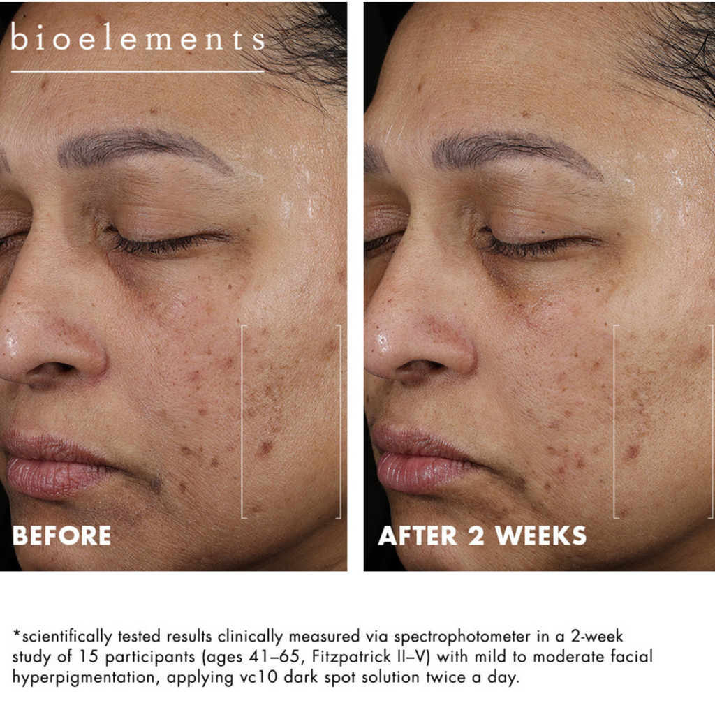 Bioelements VC10 DARK SPOT SLUTION | Šviesinantis serumas hiperpigmentacijai