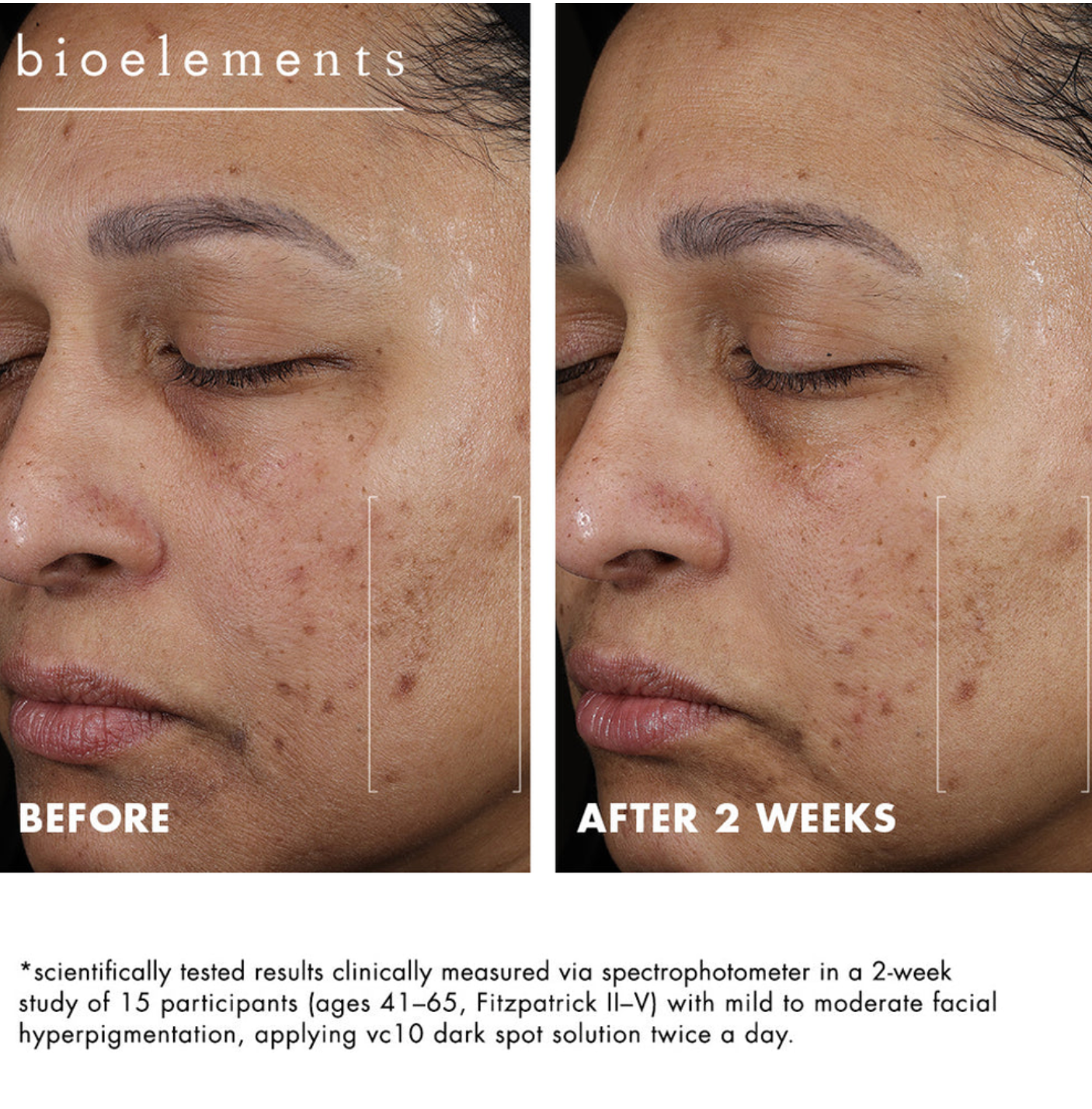 Bioelements VC10 DARK SPOT SLUTION | Šviesinantis serumas hiperpigmentacijai