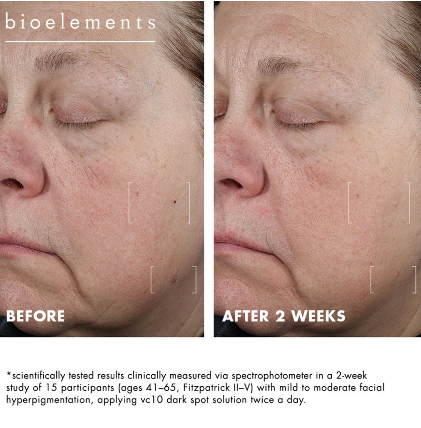 Bioelements VC10 DARK SPOT SLUTION | Šviesinantis serumas hiperpigmentacijai