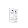 Boderm OLIPROX | Kremas seborėjinio dermatito požymiams lengvinti