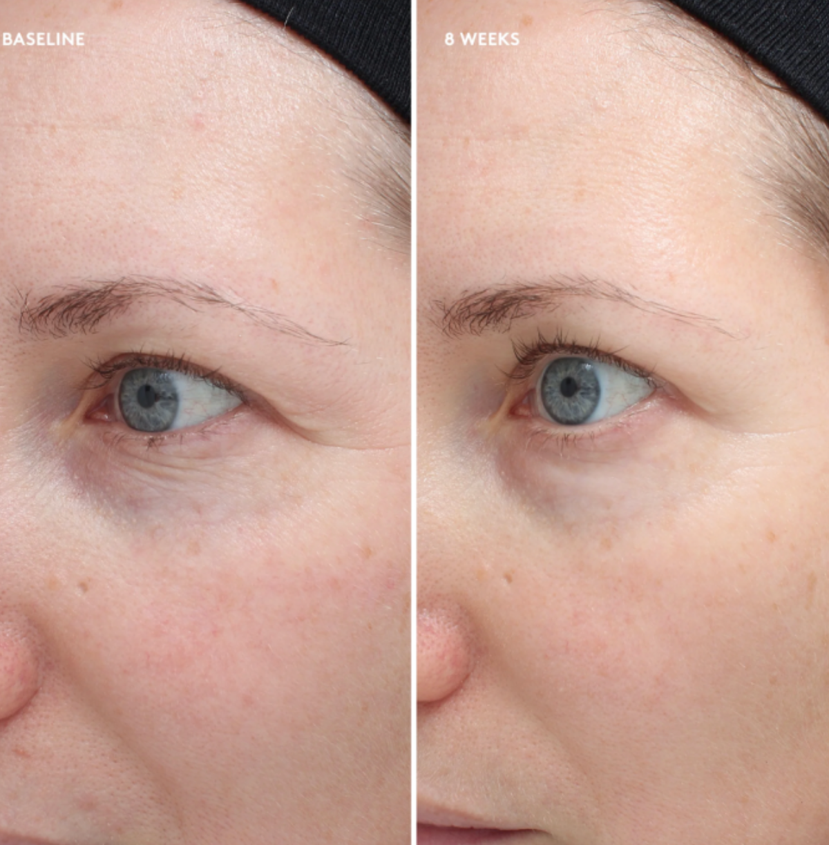 Colorescience TOTAL EYE FIRM & REPAIR CREAM | Priešraukšlinis paakių kremas