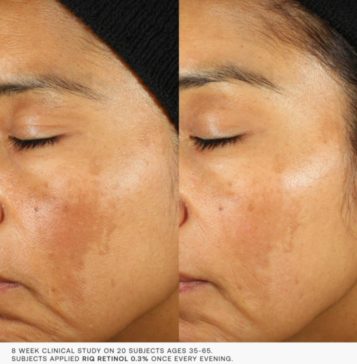 Dermaquest RiQ RETINOL | Retinolio serumas