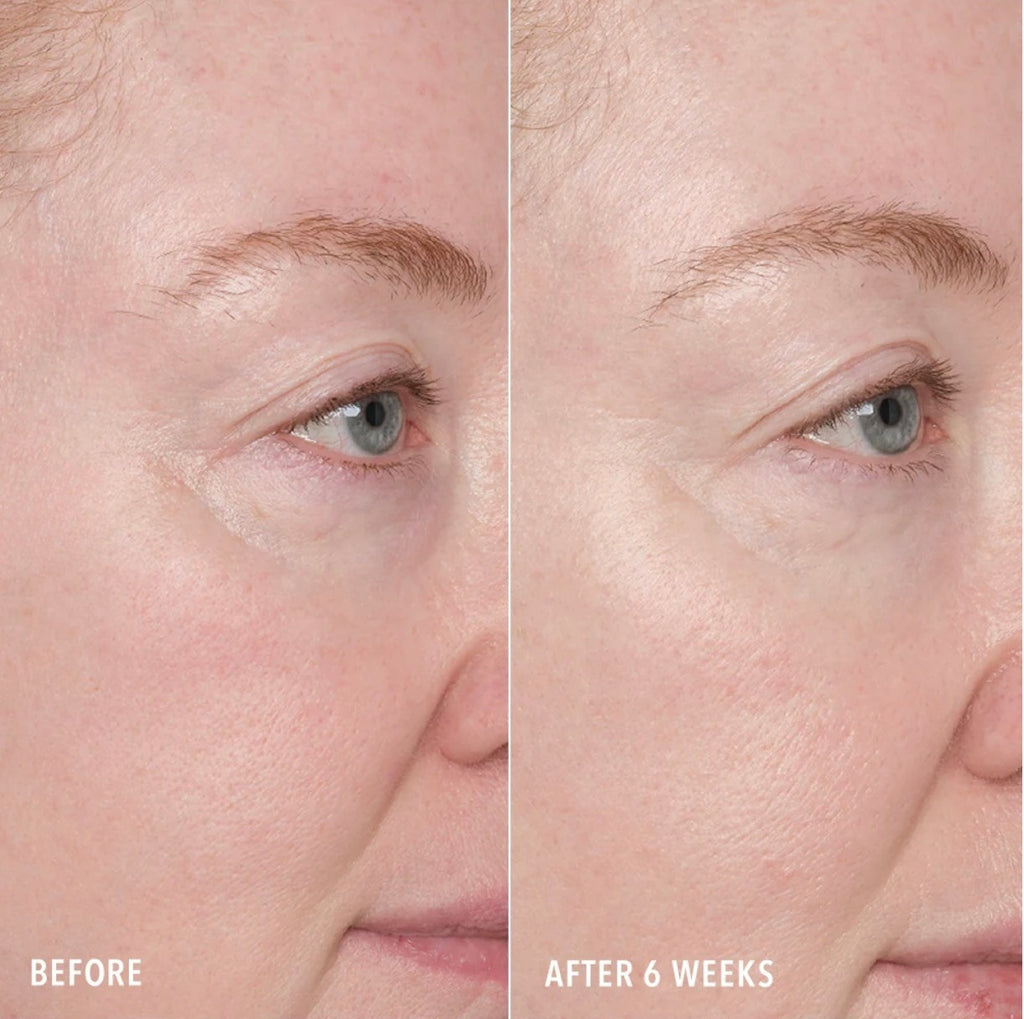 Hydropeptide RESURFACE AND REPAIR PEPTIDE PADS | Dviejų žingsnių atstatomoji procedūra