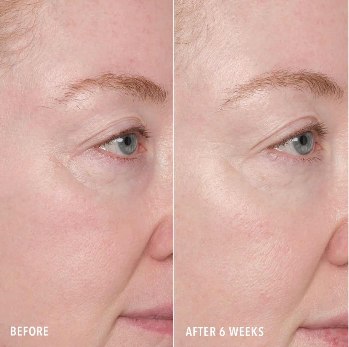 Hydropeptide RESURFACE AND REPAIR PEPTIDE PADS | Dviejų žingsnių atstatomoji procedūra