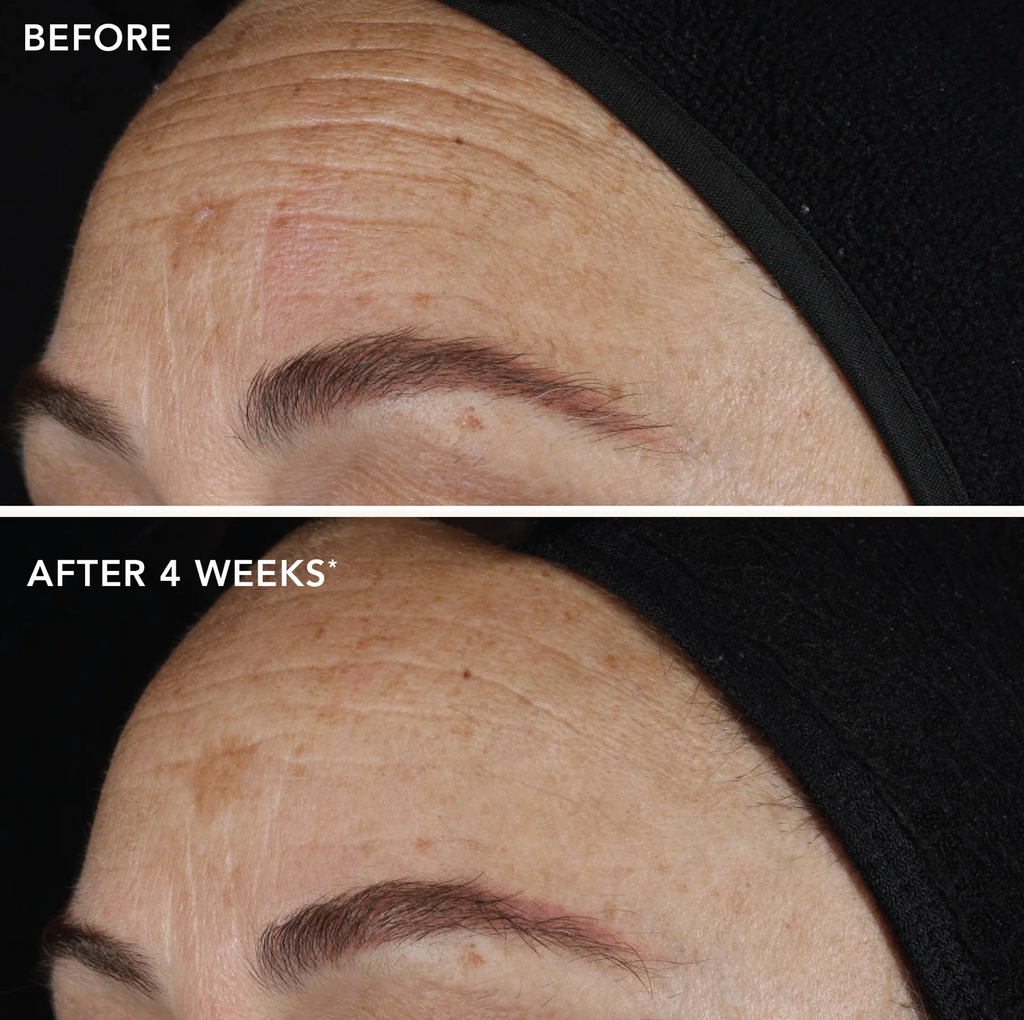 IMAGE Skincare AGELESS+ RETINOL PURE LIQUID RETINOL 0.1% | Gryno retinolio serumas