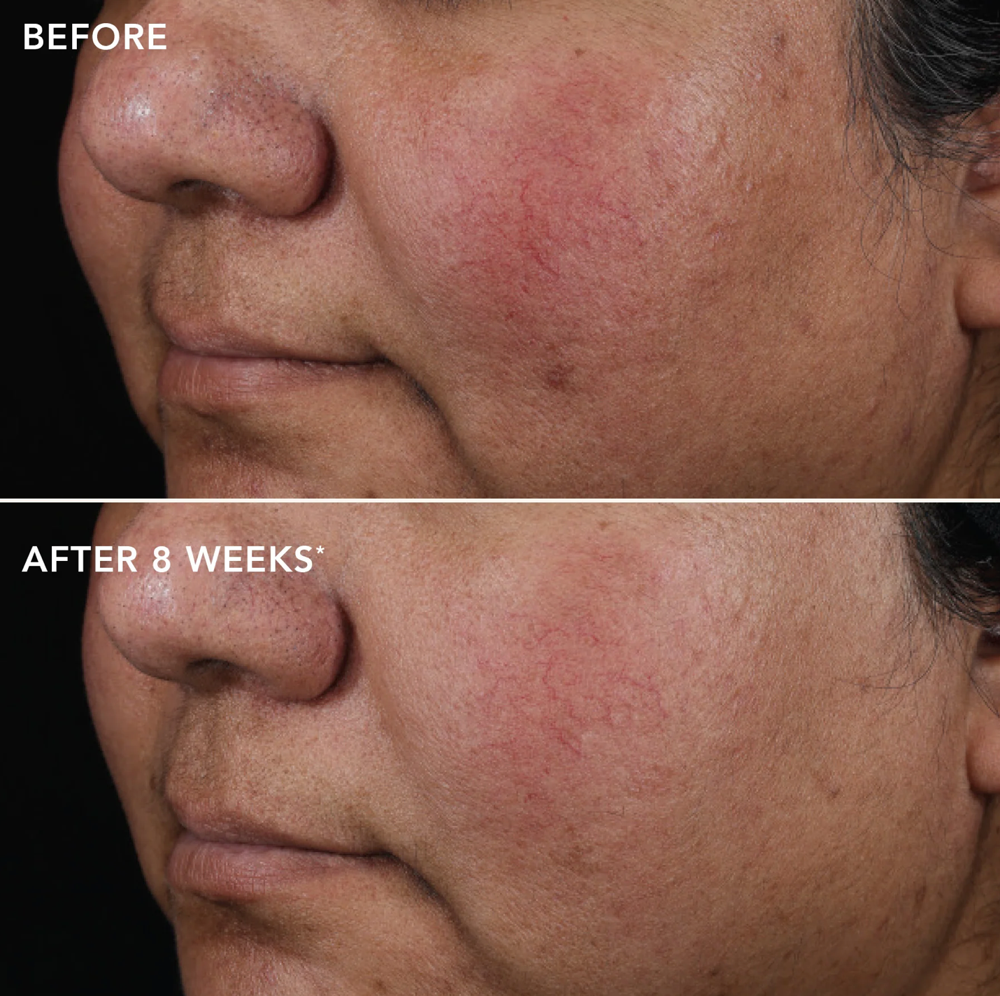 IMAGE Skincare AGELESS+ RETINOL PURE LIQUID RETINOL 0.75% | Gryno retinolio serumas
