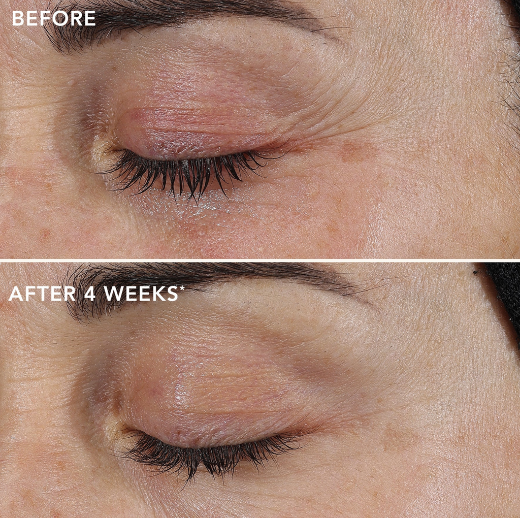 IMAGE Skincare AGELESS+ RETINOL REPAIR CRÈME 0.3% RETINOL COMPLEX | Atkuriamasis kremas su retinolio kompleksu