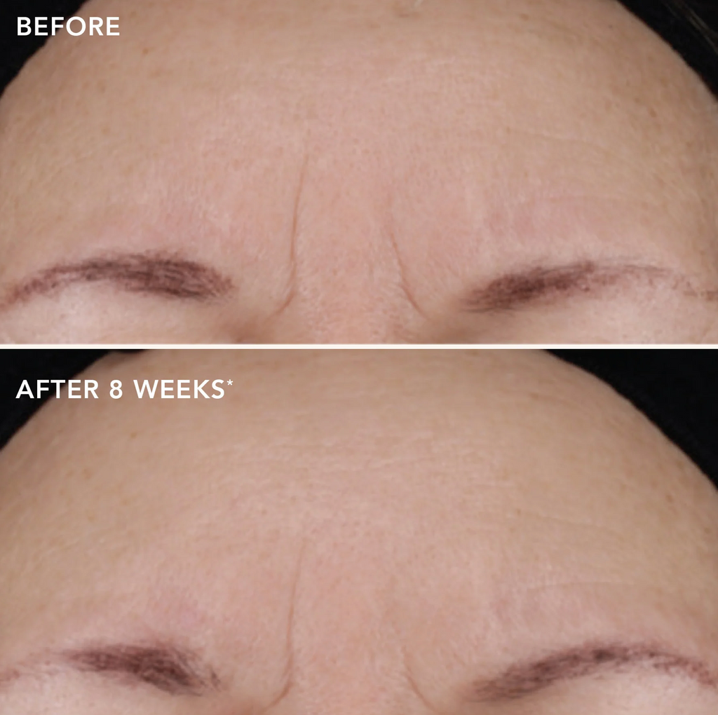 IMAGE Skincare AGELESS+ RETINOL TREATMENT CRÈME 1.2% RETINOL COMPLEX | Aktyvus kremas su retinoliu