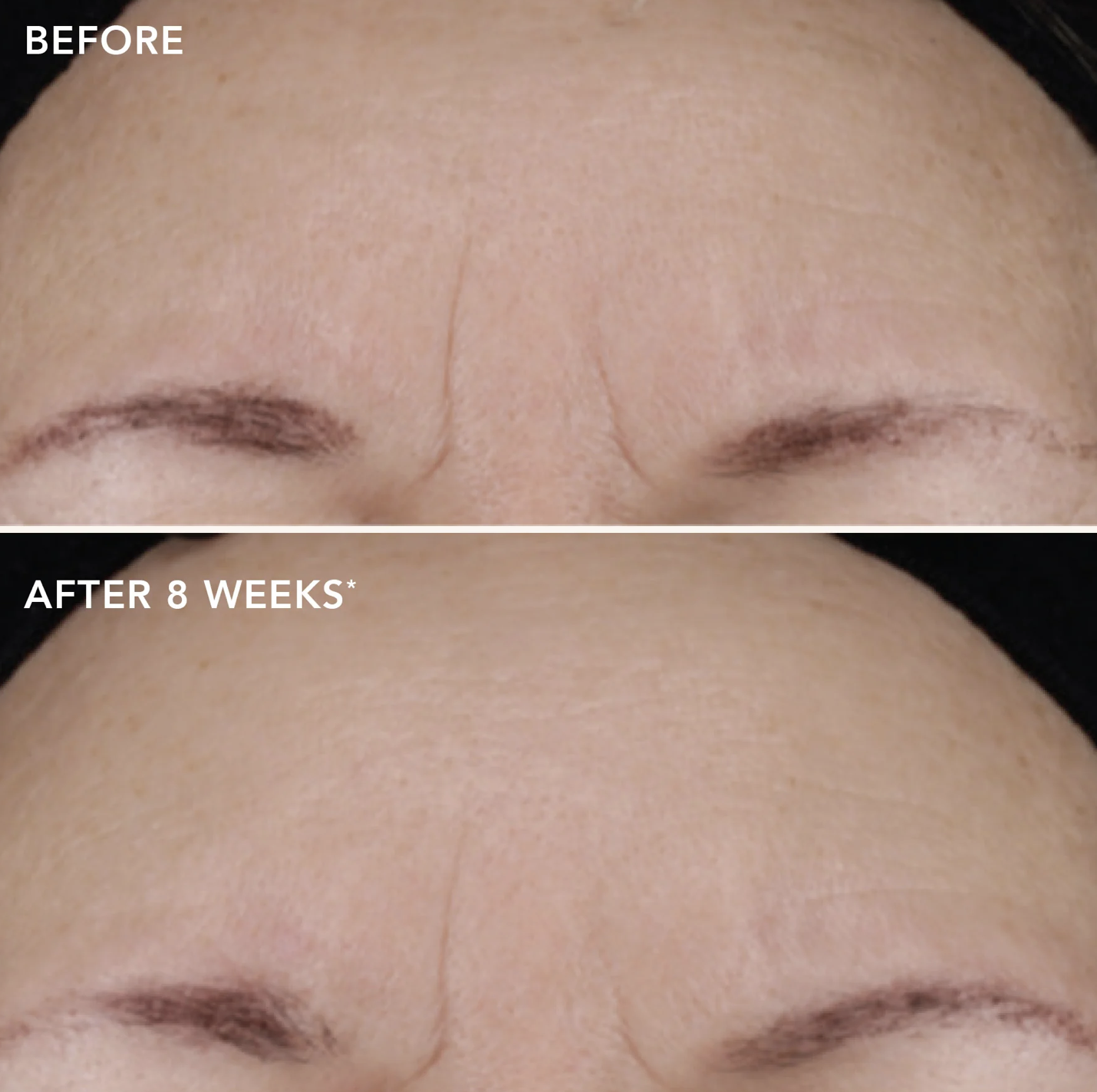 IMAGE Skincare AGELESS+ RETINOL TREATMENT CRÈME 1.2% RETINOL COMPLEX | Aktyvus kremas su retinoliu