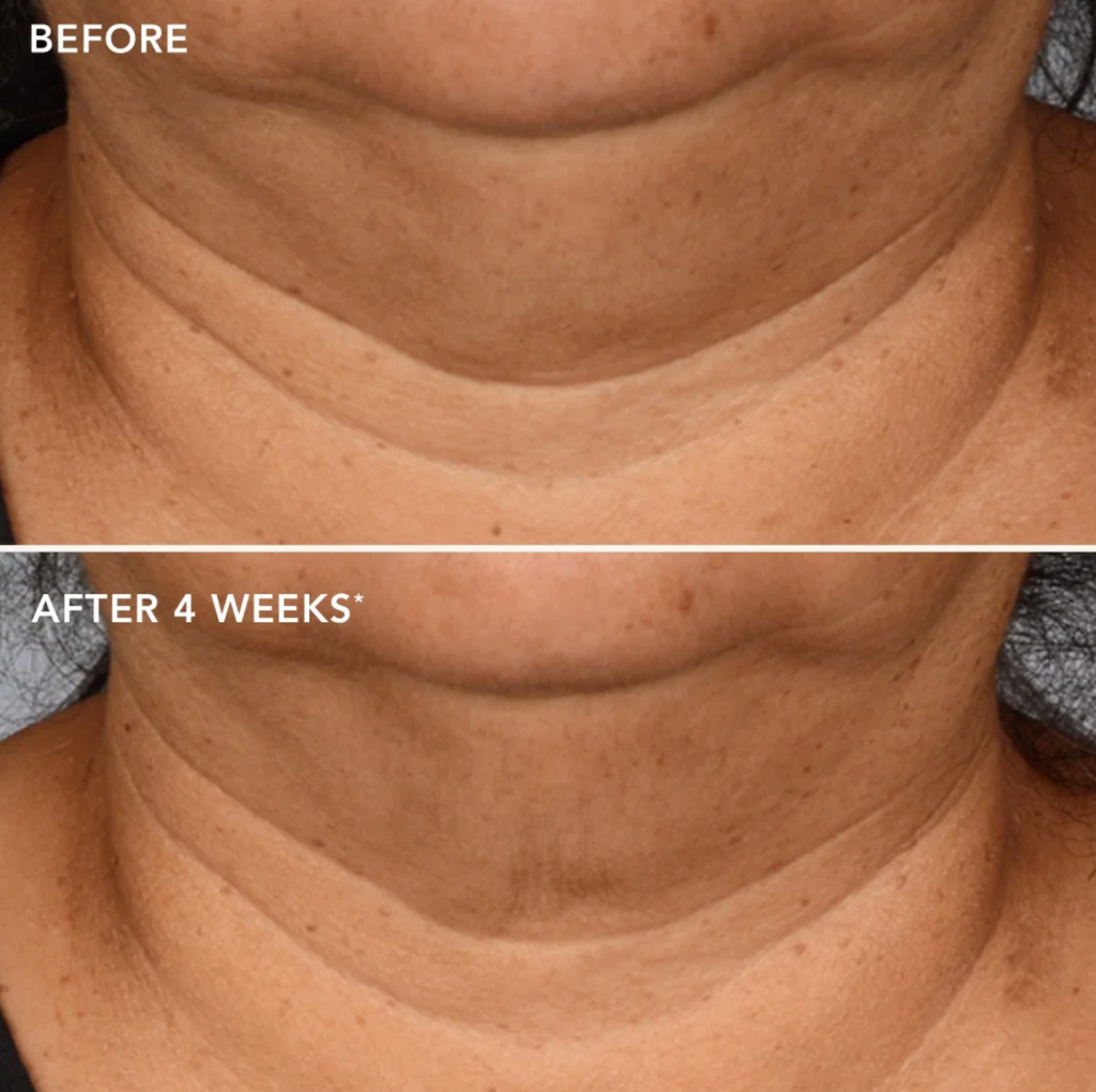 IMAGE Skincare THE MAX™ NECK LIFT | Stangrinamasis kaklo kremas su kamieninėmis ląstelėmis