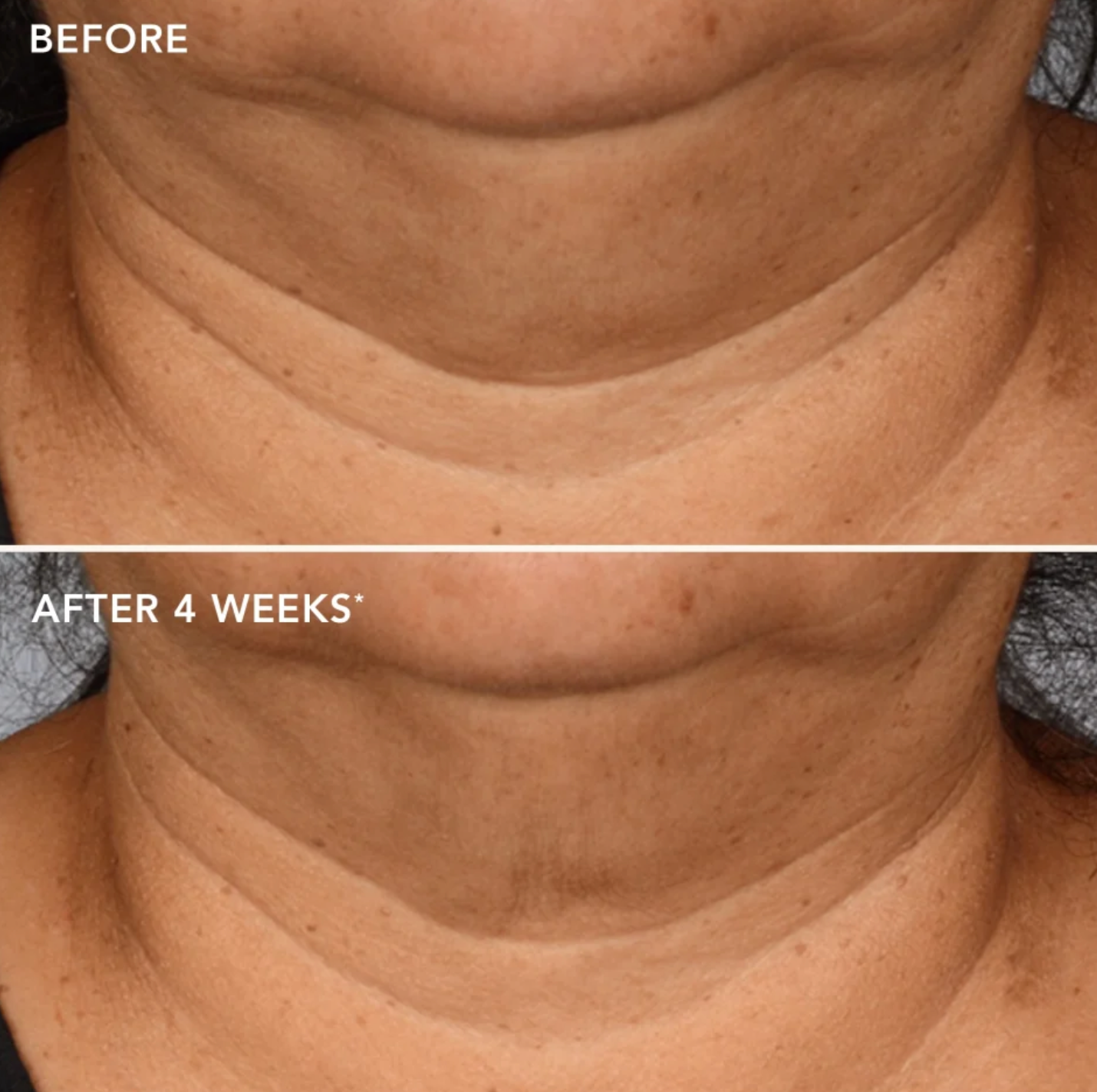 IMAGE Skincare THE MAX™ NECK LIFT | Stangrinamasis kaklo kremas su kamieninėmis ląstelėmis