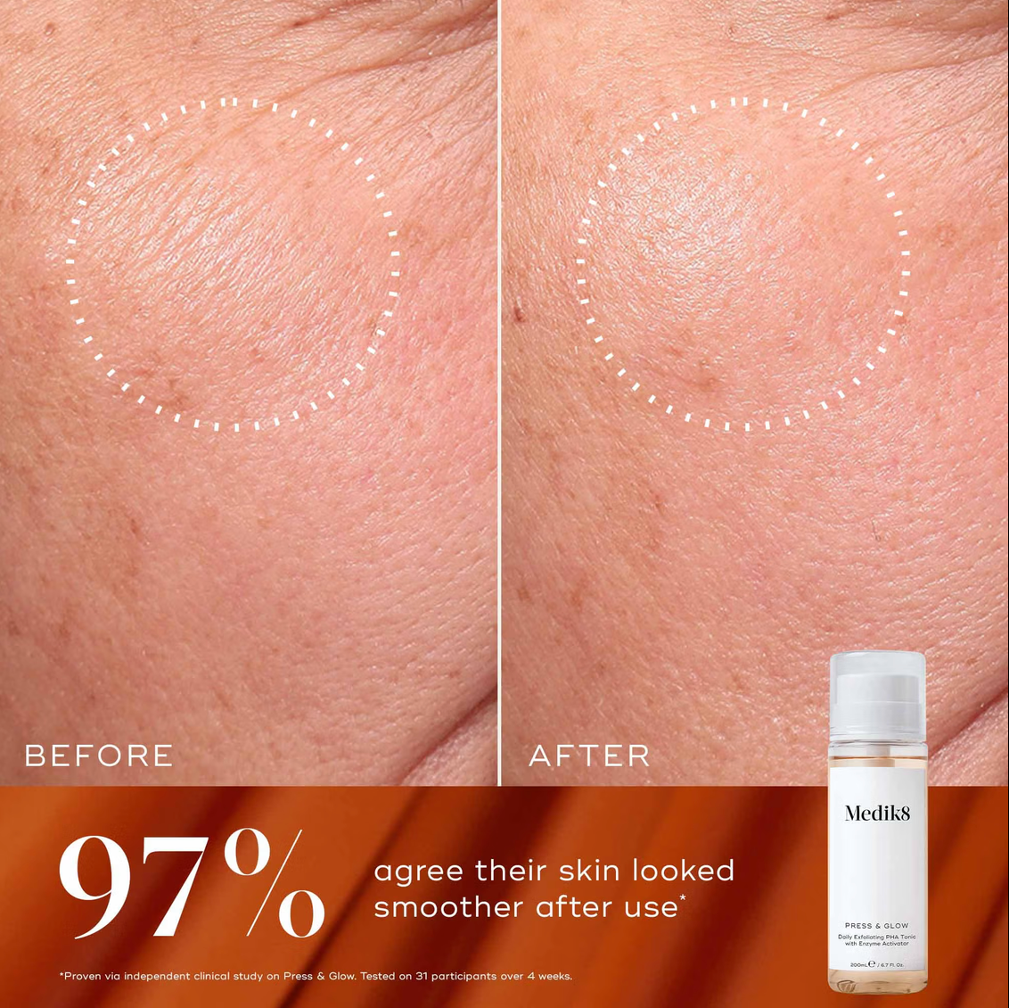 Medik8 LUMINOUS LIFT | Medik8 Rinkinys