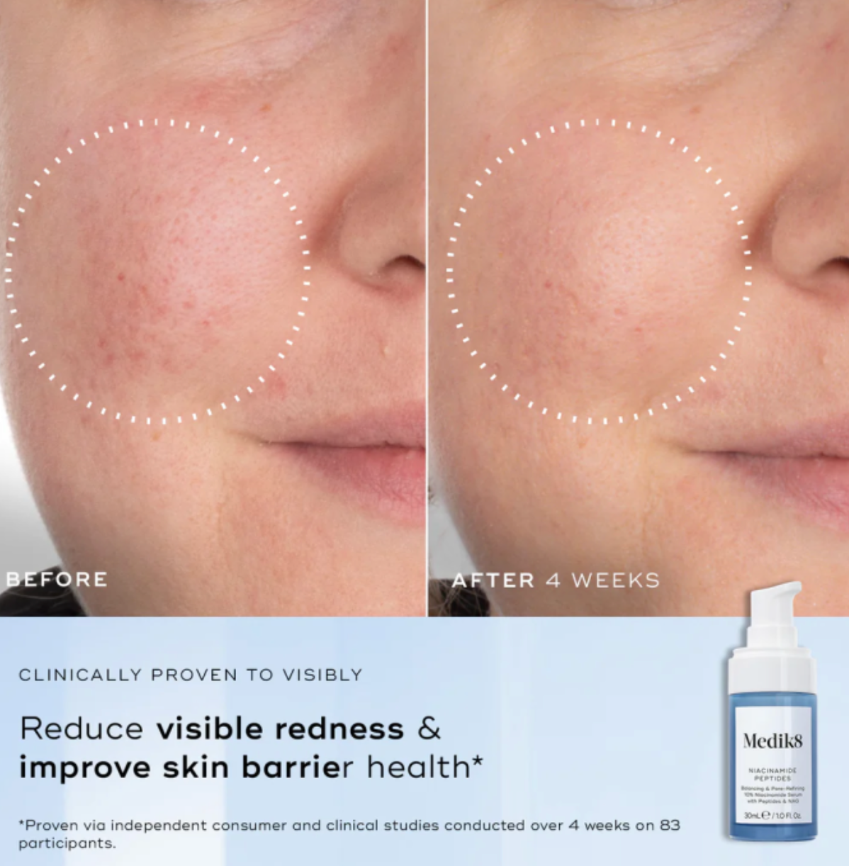 Medik8 NIACINAMIDE PEPTIDES | Serumas su 10% niacinamidu ir peptidais