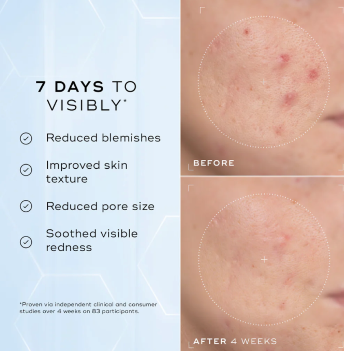 Medik8 NIACINAMIDE PEPTIDES | Serumas su 10% niacinamidu ir peptidais