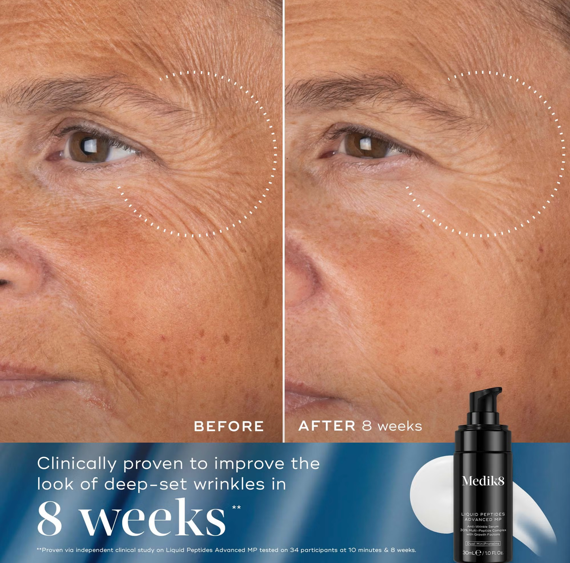 Medik8 REJUVENATION RESET | Medik8 Rinkinys