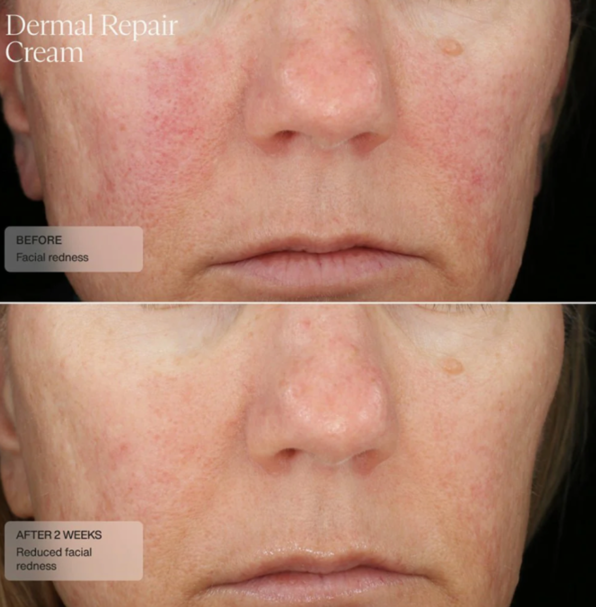 Sente DERMAL REPAIR CREAM | Drėkinantis veido kremas raudoniui