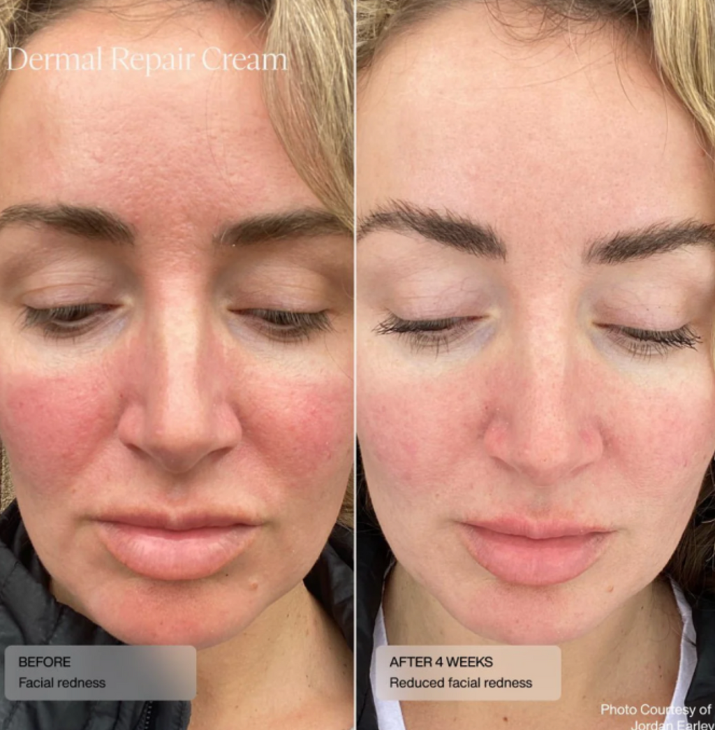 Sente DERMAL REPAIR CREAM | Drėkinantis veido kremas raudoniui