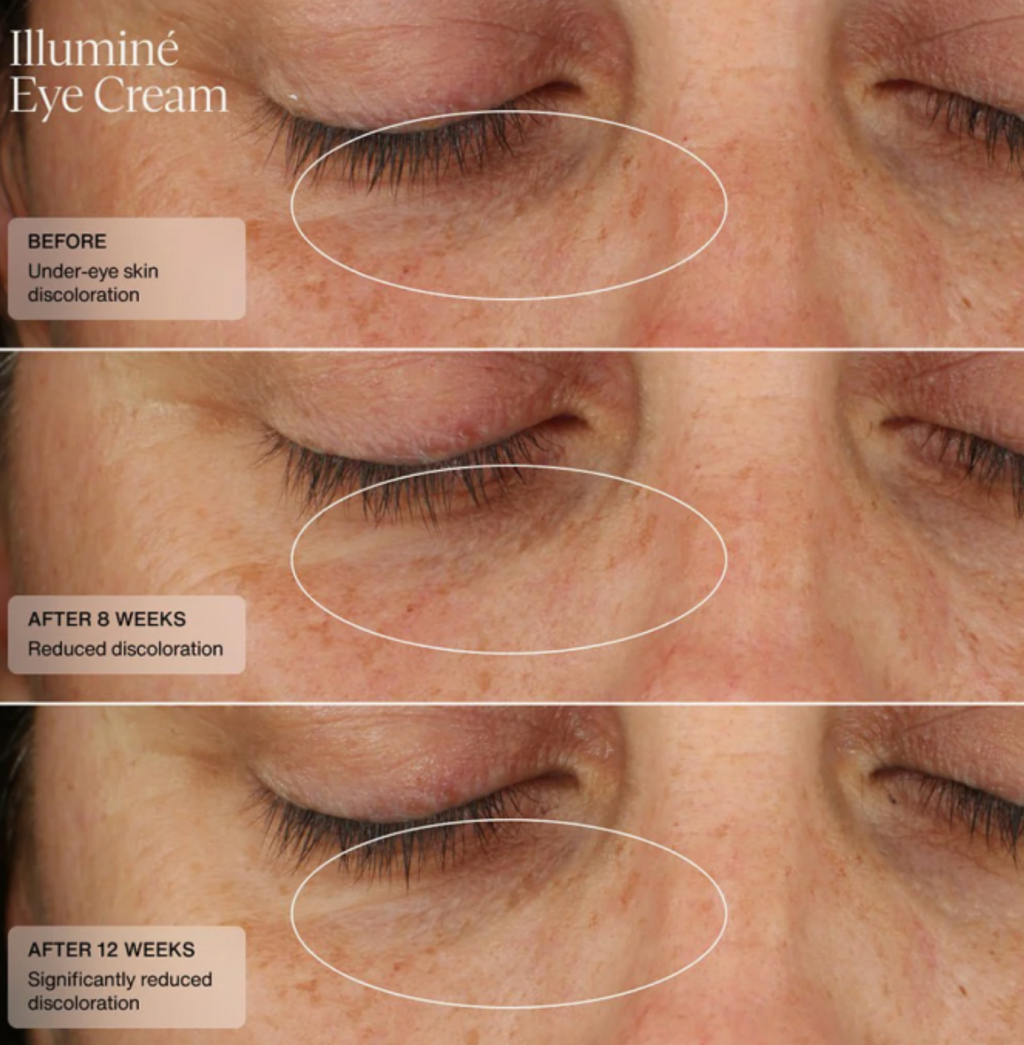Sente ILLUMINÉ EYE CREAM | Naktinis paakių kremas