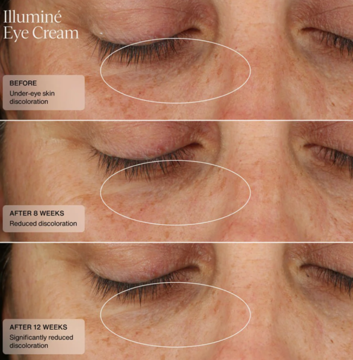 Sente ILLUMINÉ EYE CREAM | Naktinis paakių kremas