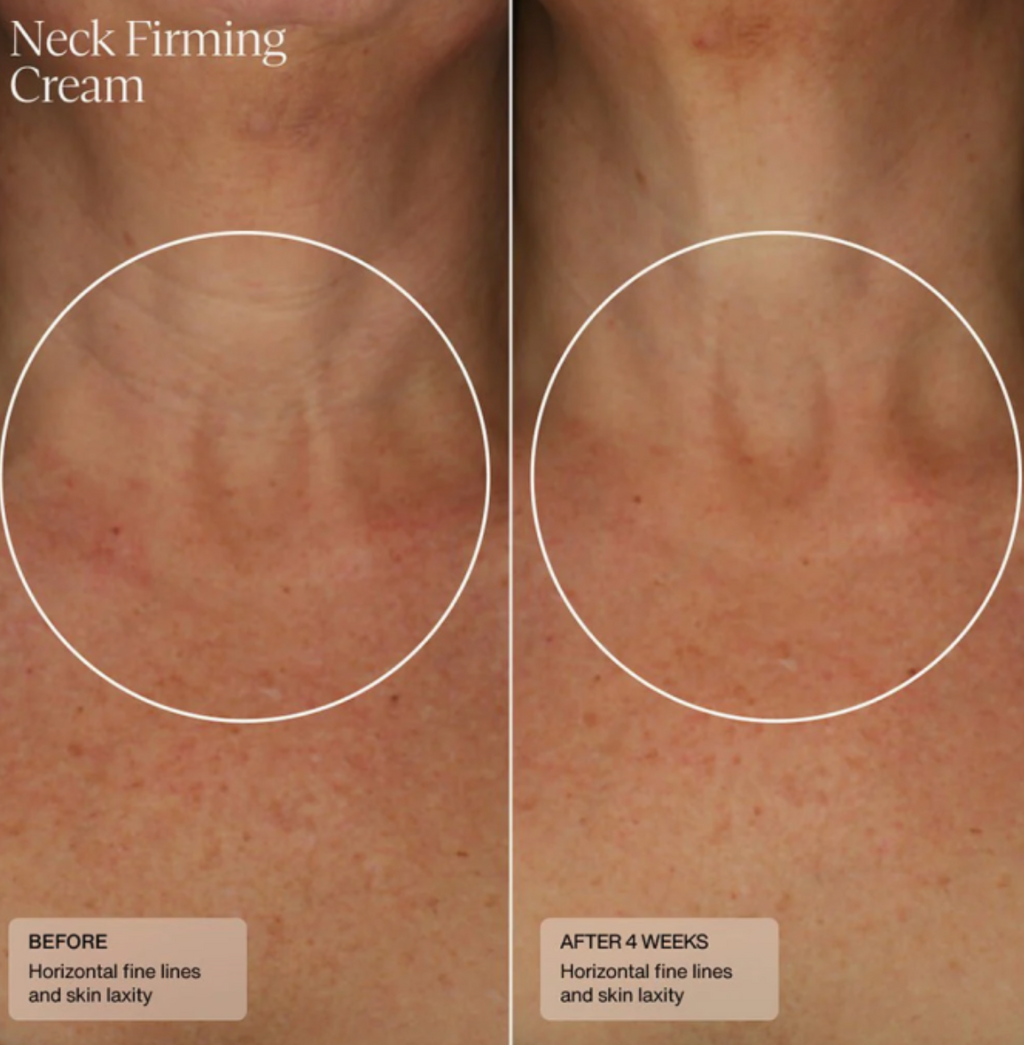 Sente NECK FIRMING CREAM | Stangrinantis kaklo kremas