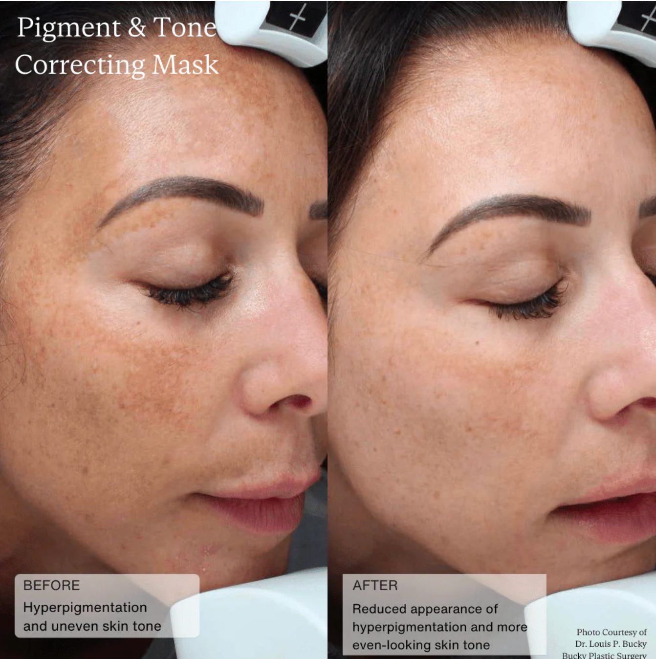 Sente PIGMENT & TONE CORRECTING MASK | Veido kaukė hiperpigmentacijos mažinimui