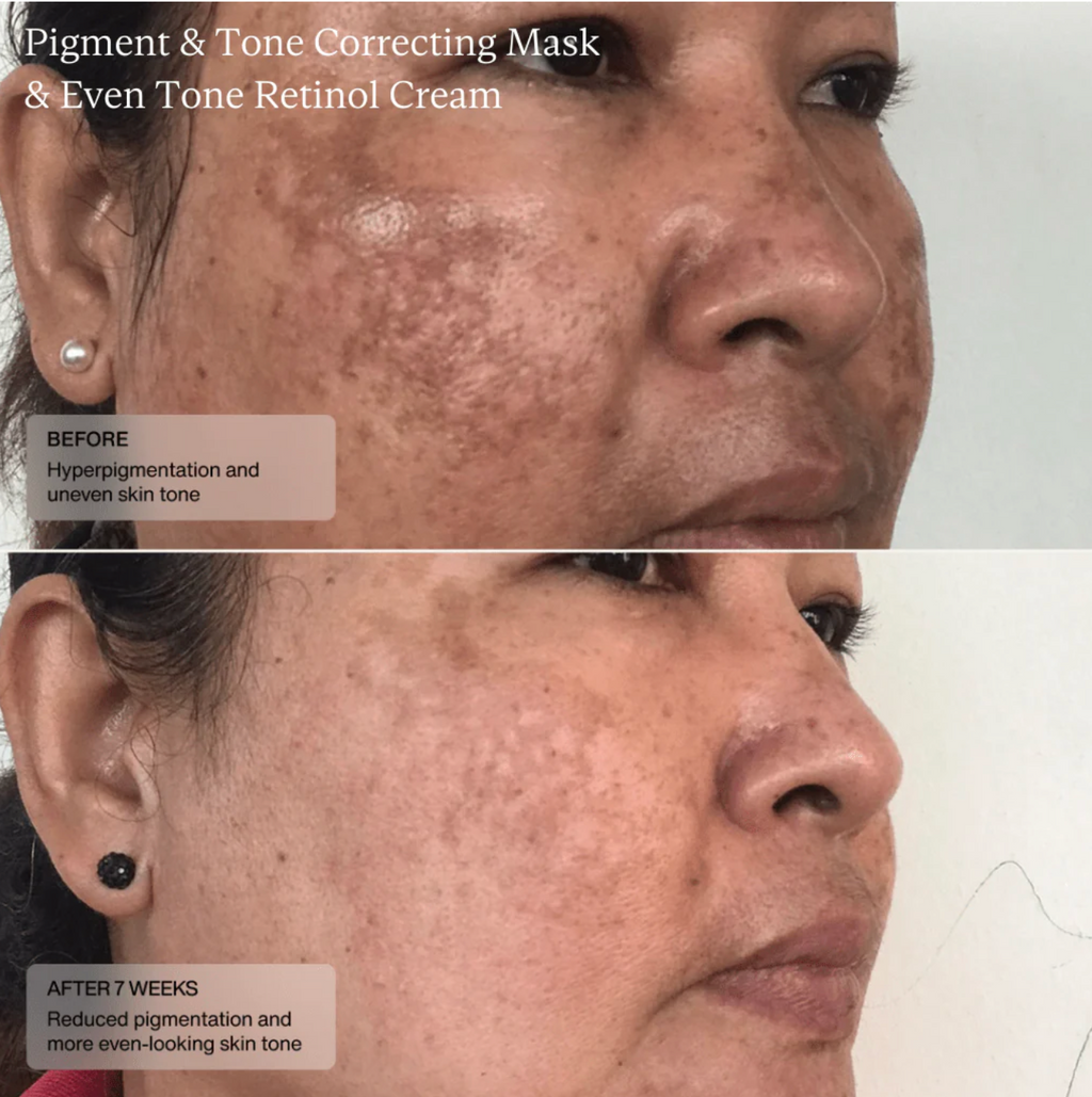 Sente PIGMENT & TONE CORRECTING MASK | Veido kaukė hiperpigmentacijos mažinimui