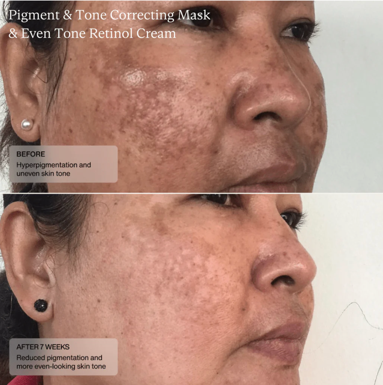 Sente PIGMENT & TONE CORRECTING MASK | Veido kaukė hiperpigmentacijos mažinimui