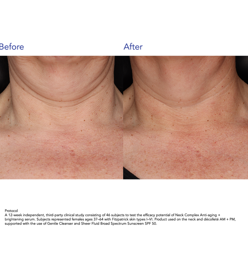 ZO Skin Health NECK COMPLEX | Daugiafunkcinis kaklo ir dekoltė kremas