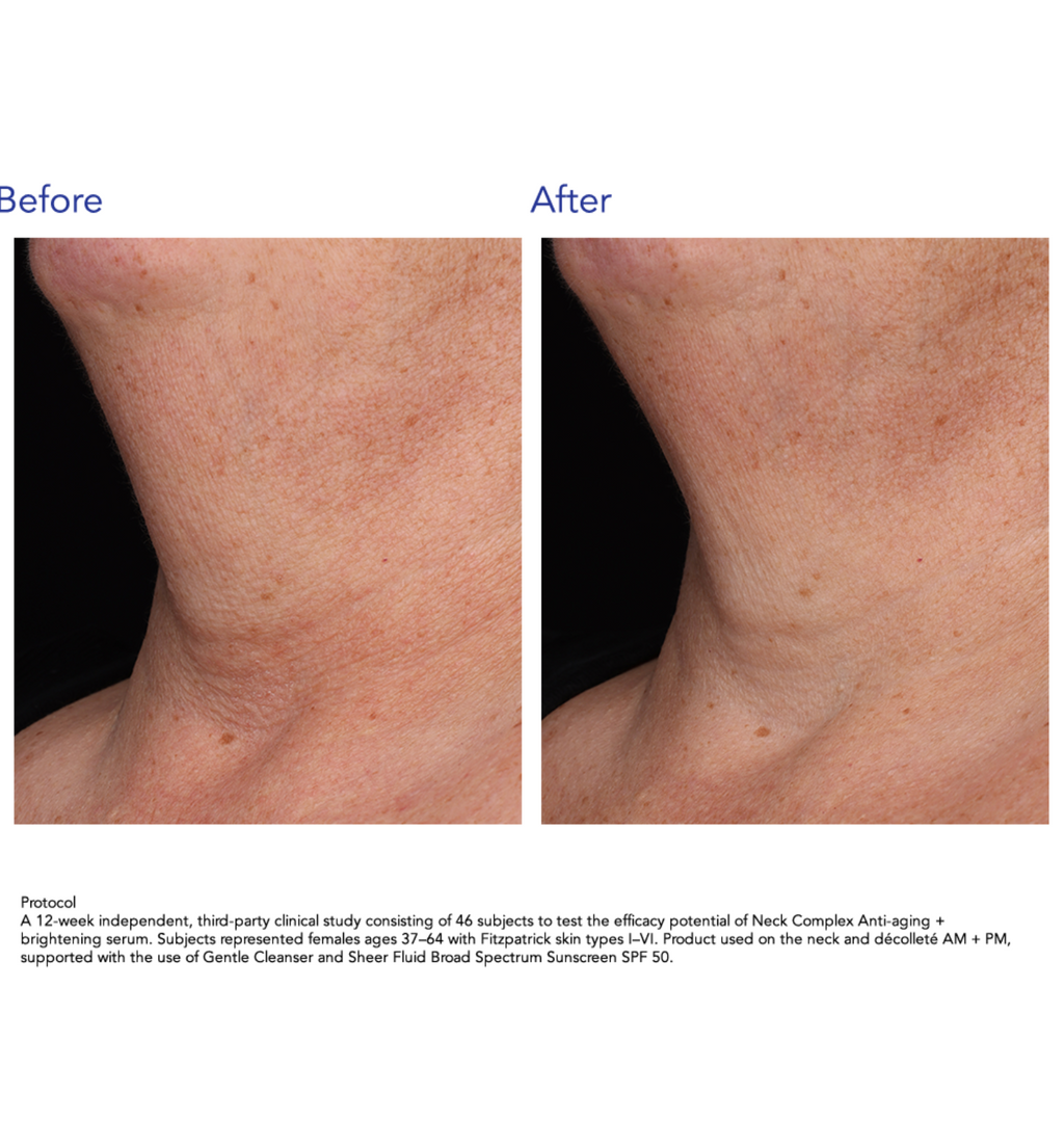 ZO Skin Health NECK COMPLEX | Daugiafunkcinis kaklo ir dekoltė kremas