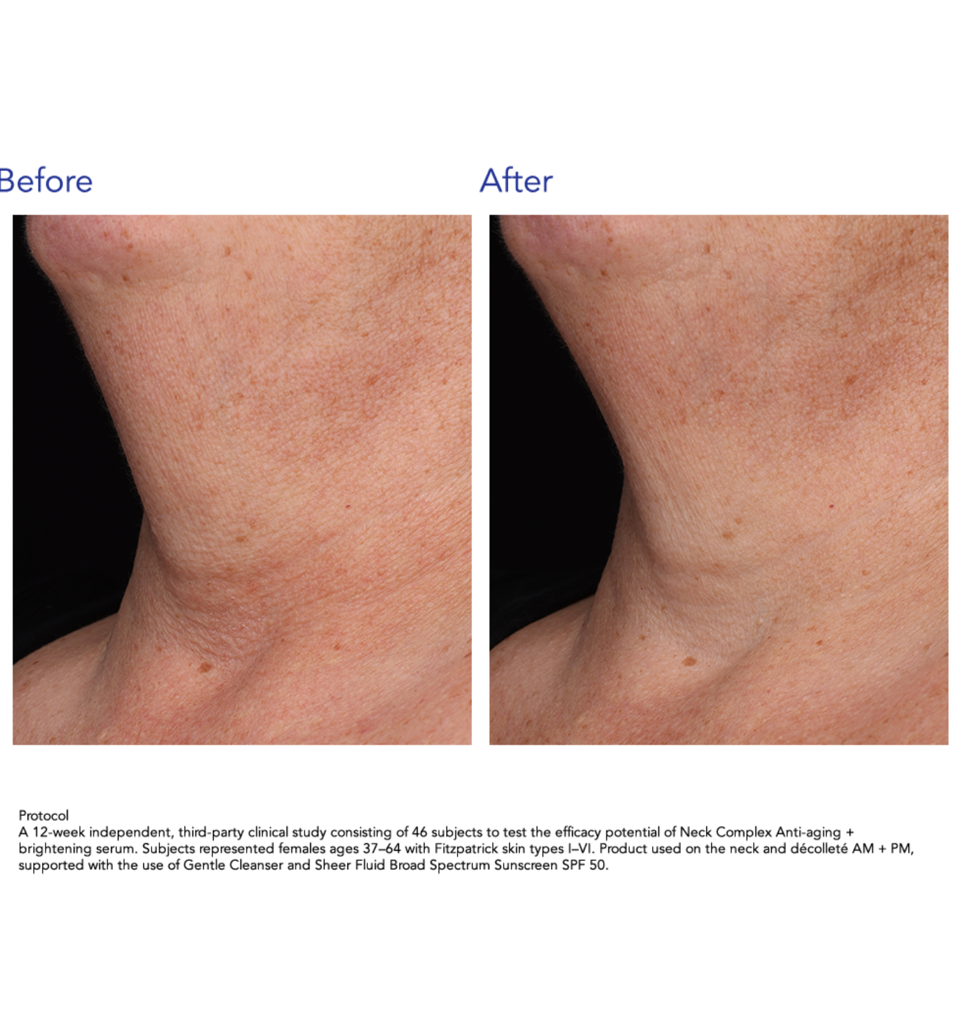 ZO Skin Health NECK COMPLEX | Daugiafunkcinis kaklo ir dekoltė kremas
