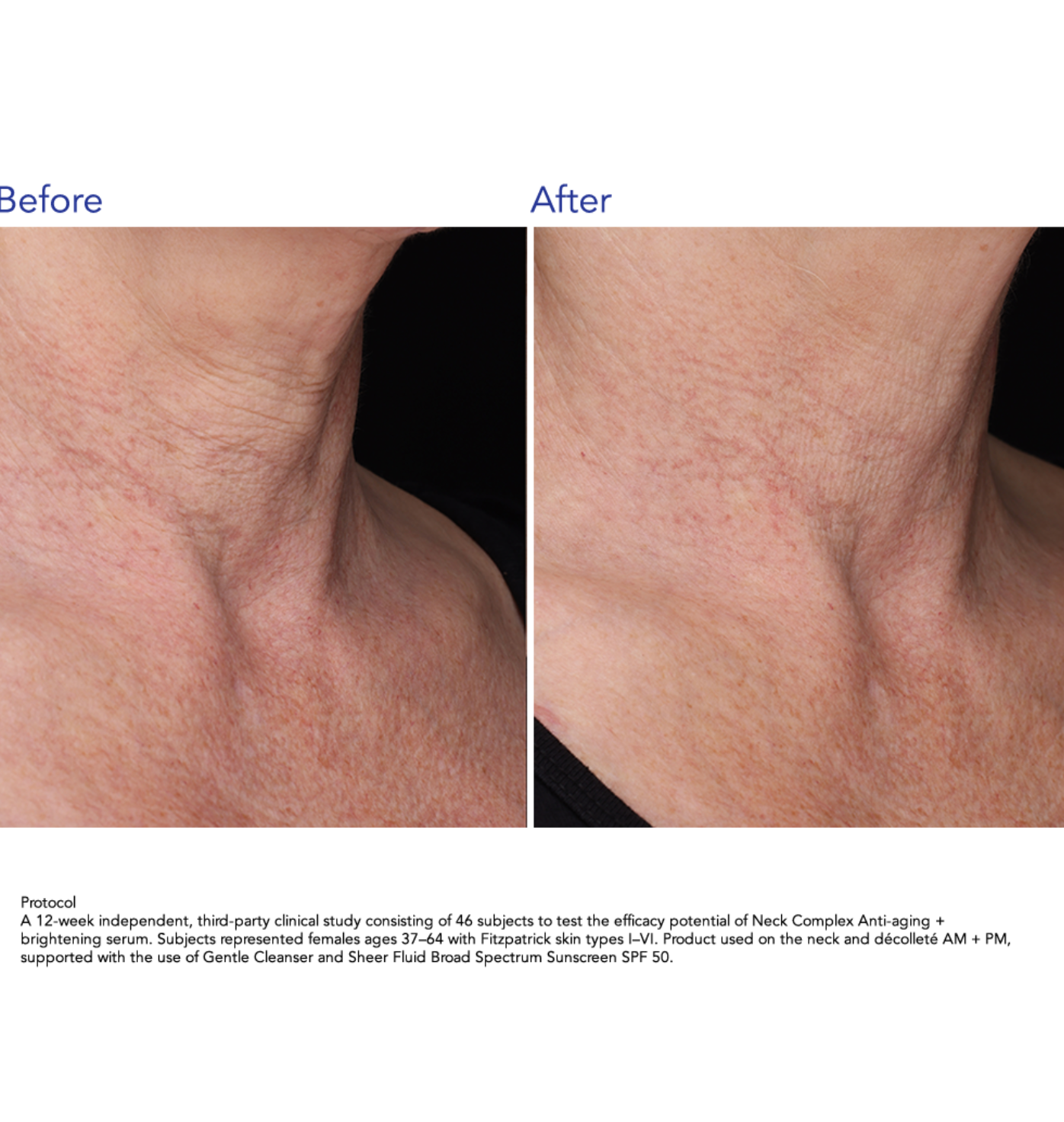ZO Skin Health NECK COMPLEX | Daugiafunkcinis kaklo ir dekoltė kremas